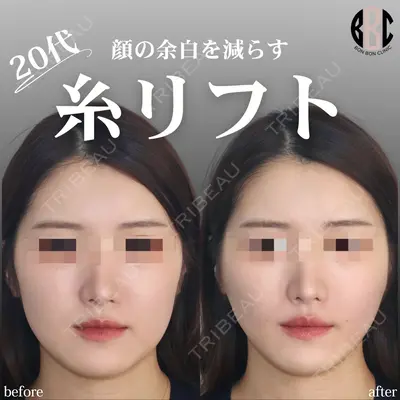 BON BON CLINIC 銀座駅前本院 池田 悠医師の症例