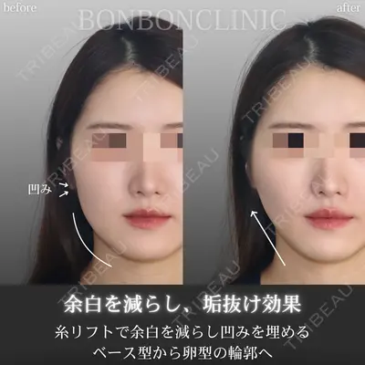 BON BON CLINIC 銀座駅前本院 池田 悠医師の症例
