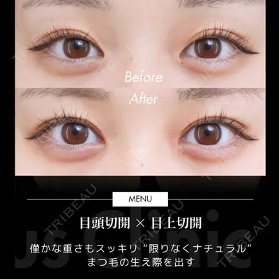 Otus Clinic 【オータスクリニック】 中 徳太郎医師の症例