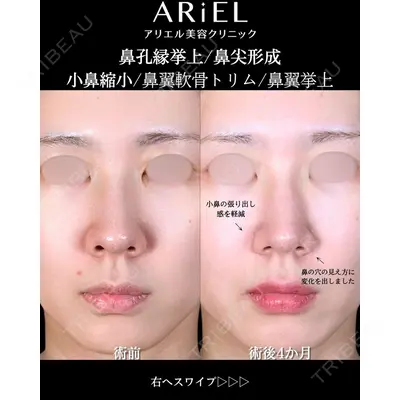 アリエル美容クリニック 大宮院 阪野 一世医師の症例