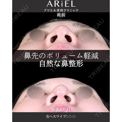 アリエル美容クリニック 大宮院 阪野 一世医師の症例