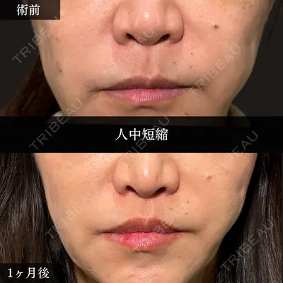 PRISM Beauty Clinic 新宿院 畑山 知輝医師の症例