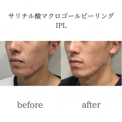 おおたかの森ビューティークリニックの症例