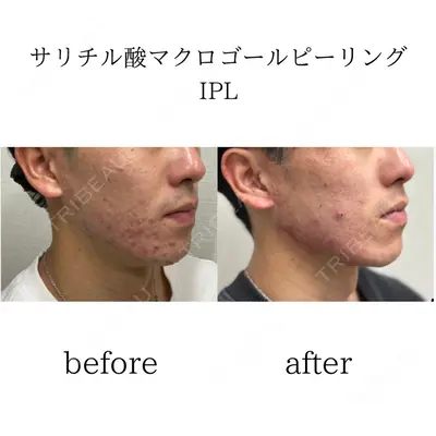 おおたかの森ビューティークリニックの症例