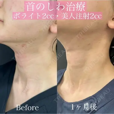 ルラ美容クリニック 渋谷本院 昼間 路子医師の症例