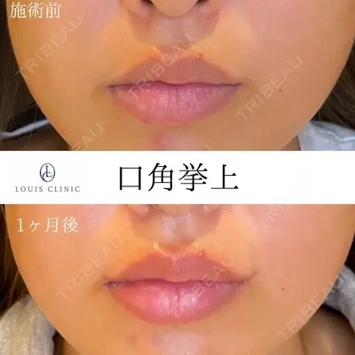 LOUIS CLINIC 二子玉川院【ルイクリニック】 小松 塁医師の症例