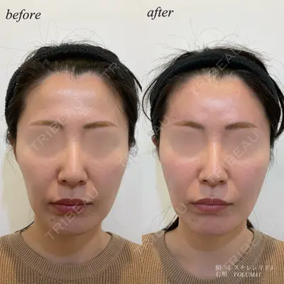 DMTC CLINIC 日本橋院 松井泉医師の症例