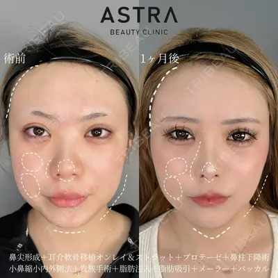 ASTRA BEAUTY CLINIC 塩満 惠子医師の症例