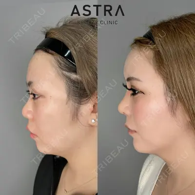ASTRA BEAUTY CLINIC 塩満 惠子医師の症例