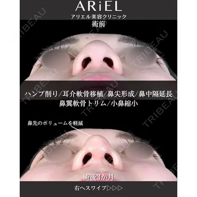 アリエル美容クリニック 大宮院 阪野 一世医師の症例