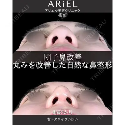 アリエル美容クリニック 大宮院 阪野 一世医師の症例