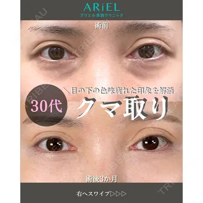 アリエル美容クリニック 大宮院 鈴木　桂介医師の症例