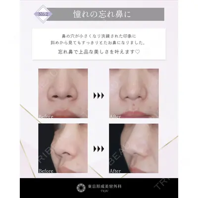 東京形成美容外科 船橋院の症例