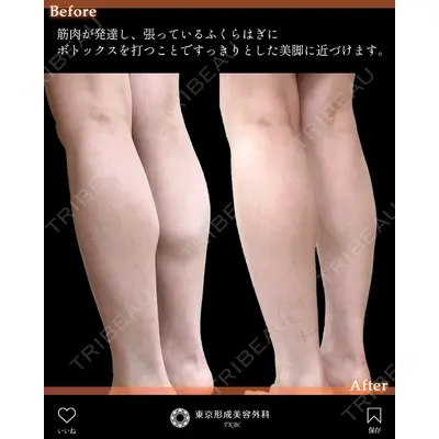 東京形成美容外科 船橋院の症例