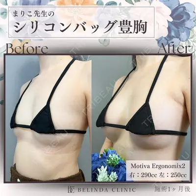 BELINDA CLINIC（ベリンダクリニック）新宿院 井上 真梨子医師の症例