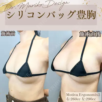 BELINDA CLINIC（ベリンダクリニック）新宿院 井上 真梨子医師の症例