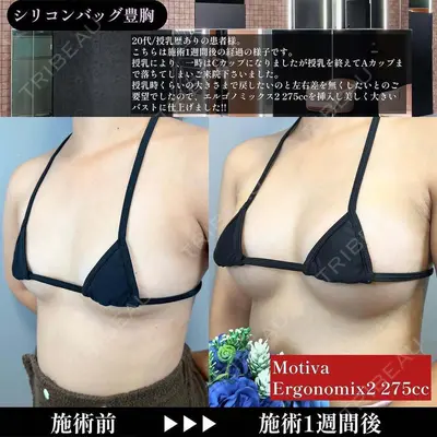 BELINDA CLINIC（ベリンダクリニック）新宿院 井上 真梨子医師の症例