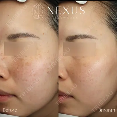 NEXUS CLINICの症例
