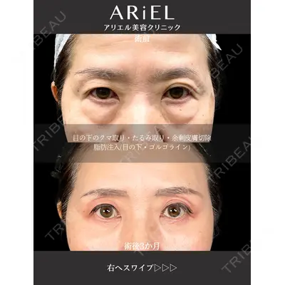 アリエル美容クリニック 大宮院 鈴木　桂介医師の症例