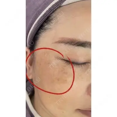 しんゆり美容健康クリニックの症例