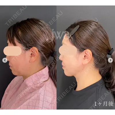 自由が丘ウェルエイジングビューティークリニック 福田 知佐子医師の症例