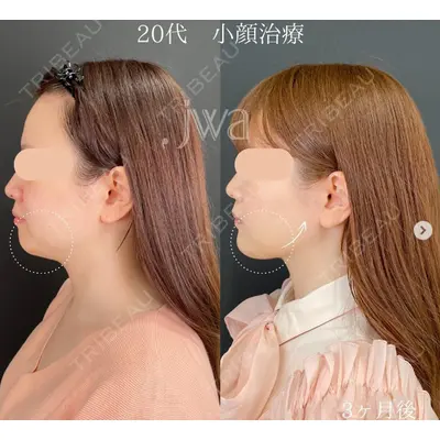 自由が丘ウェルエイジングビューティークリニック 福田 知佐子医師の症例