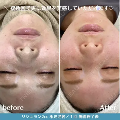 エスクリニック 恵比寿の症例