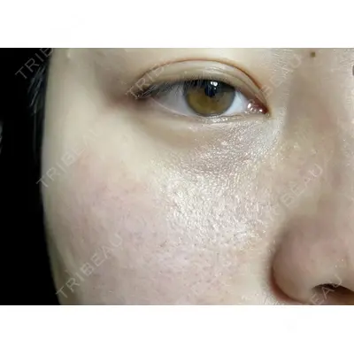 しんゆり美容健康クリニックの症例