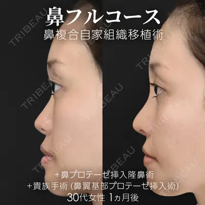 ジョウクリニック 銀座院 重本　譲医師の症例