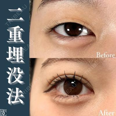 BELINDA CLINIC（ベリンダクリニック）岡山院の症例