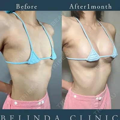 BELINDA CLINIC（ベリンダクリニック）柏院 大窪 修平医師の症例