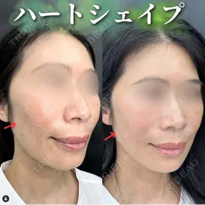 ルラ美容クリニック 京都院の症例