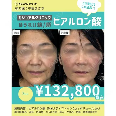 カジュアルクリニック 平塚院の症例