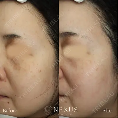 NEXUS CLINICの症例