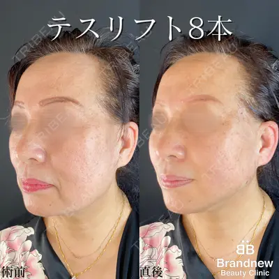 Brandnew Beauty Clinicの症例