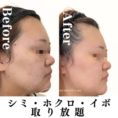 Mavie Beauty Clinic （マヴィービューティークリニック）の症例