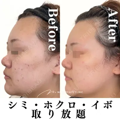 Mavie Beauty Clinic （マヴィービューティークリニック）の症例