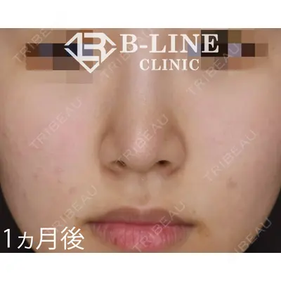 B-LINE CLINIC 池袋院 小池 康弘医師の症例