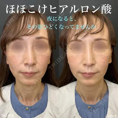 ルラ美容クリニック 名古屋栄院 / ルラスキンクリニック 名古屋栄院 関戸 優医師の症例