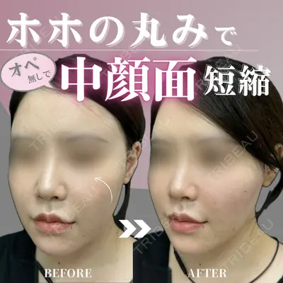 ルラ美容クリニック銀座院 山本 泰輔医師の症例