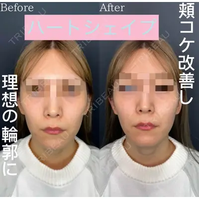 ルラ美容クリニック 京都院の症例