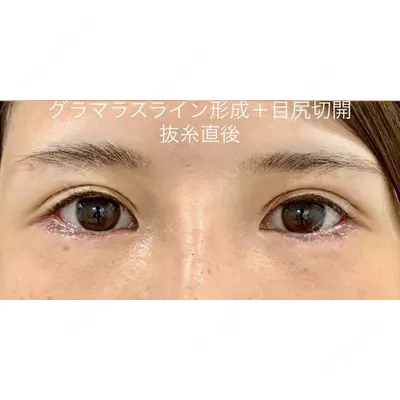 ルラ美容クリニック 渋谷本院 武内 大医師の症例