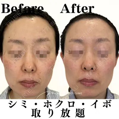 Mavie Beauty Clinic （マヴィービューティークリニック）の症例