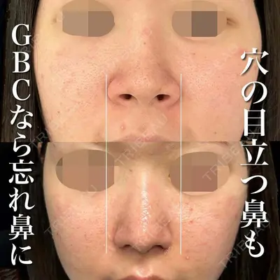 グローバルビューティークリニック 銀座院 理事長　杉崎　裕斗医師の症例