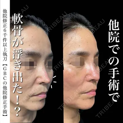 グローバルビューティークリニック 銀座院 理事長　杉崎　裕斗医師の症例