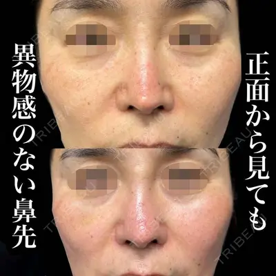 グローバルビューティークリニック 銀座院 理事長　杉崎　裕斗医師の症例