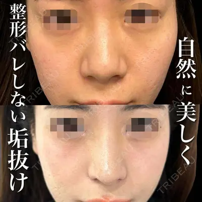 グローバルビューティークリニック 銀座院 理事長　杉崎　裕斗医師の症例