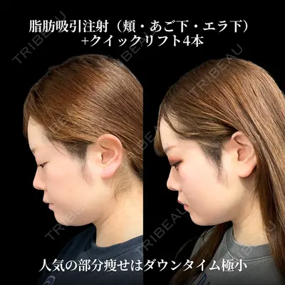 東京シンデレラ美容外科 大宮院 竹田 昌平医師の症例