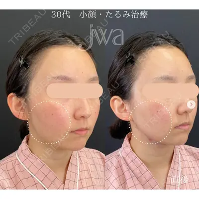 自由が丘ウェルエイジングビューティークリニック 福田 知佐子医師の症例