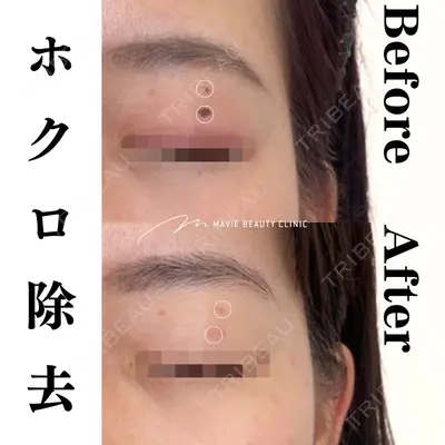 Mavie Beauty Clinic （マヴィービューティークリニック）の症例